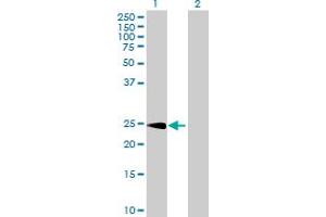 Western Blot analysis of CPSF4 expression in transfected 293T cell line by CPSF4 MaxPab polyclonal antibody. (CPSF4 Antikörper  (AA 1-243))