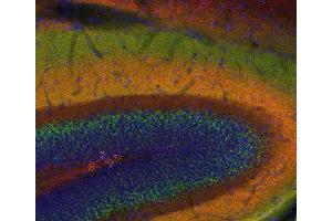 Indirect immunostaining of a PFA fixed mouse hippocampus section with anti-SNAP 25 (dilution 1 : 200; red) and guinea pig anti-VGluT 2 (, dilution 1 : 200; green).