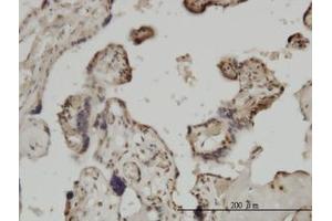 Image no. 3 for anti-Zic Family Member 4 (ZIC4) (AA 249-320) antibody (ABIN466252) (ZIC4 Antikörper  (AA 249-320))