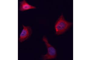 ABIN6261464 and ABIN6276554 staining HeLa cells by ICC/IF.