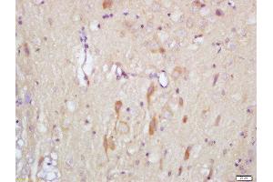 Formalin-fixed and paraffin embedded rat brain labeled with Rabbit Anti-Slitrk1 Polyclonal Antibody, Unconjugated (ABIN715556) at 1:200 followed by conjugation to the secondary antibody and DAB staining (SLITRK1 Antikörper  (AA 21-120))