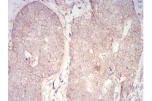 Immunohistochemistry (IHC) image for anti-3-phosphoinositide Dependent Protein Kinase-1 (PDPK1) (AA 457-556) antibody (ABIN5855659) (PDPK1 Antikörper  (AA 457-556))