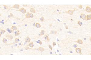 Immunohistochemistry (IHC) image for anti-Complement Factor I (CFI) (AA 28-243) antibody (ABIN7444067)