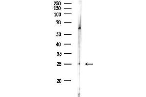 Western blot analysis of lysates from Rat lung, using ATP6V1D Antibody at 1/1000 dilution.