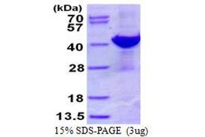 Image no. 1 for ADP-Ribosylarginine Hydrolase (ADPRH) protein (His tag) (ABIN1098340)
