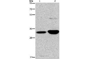 Western blot analysis of Human fetal brain and mouse brain tissue, using MAPRE3 Polyclonal Antibody at dilution of 1:500 (MAPRE3 Antikörper)
