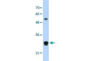 Western Blot analysis of HepG2 cell lysate with IGSF1 polyclonal antibody  at 1. (IGSF1 Antikörper  (N-Term))