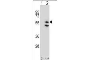 Western blot analysis of TUFM (arrow) using rabbit polyclonal TUFM Antibody (C-term) (ABIN656840 and ABIN2846048).