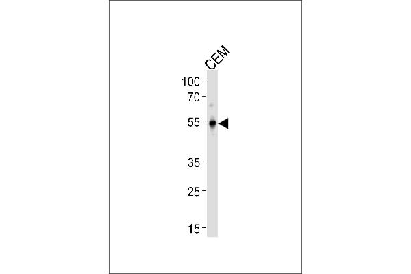 KLF5 Antikörper  (C-Term)