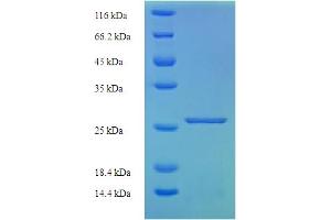 SDS-PAGE (SDS) image for Murinoglobulin 1 (Mug1) (AA 700-910), (partial) protein (His tag) (ABIN5710860)