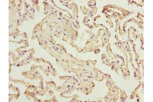 Immunohistochemistry of paraffin-embedded human lung tissue using ABIN7175170 at dilution of 1:100 (RAD23A Antikörper  (AA 2-201))