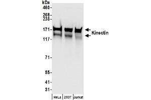 anti-Kinectin 1 (Kinesin Receptor) (KTN1) (AA 1307-1357) antibody