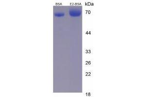 Image no. 2 for E2 Estradiol protein (BSA) (ABIN1880183) (E2 Estradiol Protein (BSA))