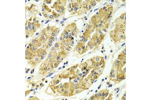 Immunohistochemistry of paraffin-embedded Human gastric using ARHGAP25 antibody at dilution of 1:100 (x400 lens).