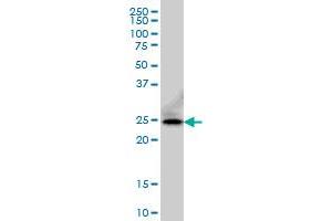 FADD monoclonal antibody (M01), clone 3A12 Western Blot analysis of FADD expression in A-431 . (FADD Antikörper  (AA 109-208))