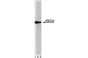 Western blot analysis of IAK1 on a Jurkat cell lysate (Human T-cell leukemia, ATCC TIB-152). (Aurora A Antikörper  (AA 8-116))