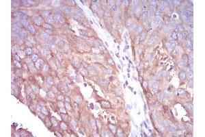 Immunohistochemistry (IHC) image for anti-Tubulin, beta 1 (TUBB1) (AA 33-166) antibody (ABIN5879491) (TUBB1 Antikörper  (AA 33-166))