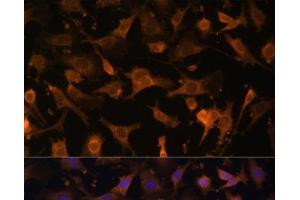 Immunofluorescence analysis of C6 cells using UFC1 Polyclonal Antibody at dilution of 1:100 (40x lens).