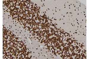 ABIN6263445 and ABIN6276995 at 1/100 staining Rat brain tissue by IHC-P. (MVP Antikörper  (N-Term))