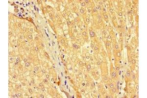 Immunohistochemistry of paraffin-embedded human liver tissue using ABIN7175490 at dilution of 1:100 (SEC22A Antikörper  (AA 10-187))