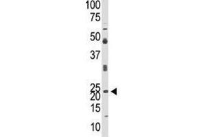 Image no. 1 for anti-Neurogenin 1 (NEUROG1) (N-Term) antibody (ABIN357407) (Neurogenin 1 Antikörper  (N-Term))