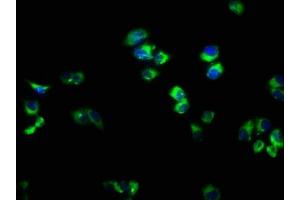 Immunofluorescence staining of PC-3 cells with ABIN7167298 at 1:166, counter-stained with DAPI. (RAB33A Antikörper  (AA 1-237))