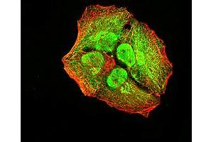 Immunofluorescence (IF) image for anti-Activin Receptor Type I (ACRV1) (AA 21-120) antibody (ABIN5611297)