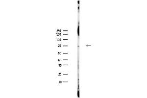 anti-Thioredoxin Domain Containing 2 (TXNDC2) antibody