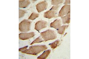 Formalin-fixed and paraffin-embedded human skeletal muscle reacted with ARPC1A Antibody (C-term), which was peroxidase-conjugated to the secondary antibody, followed by DAB staining. (ARPC1A Antikörper  (C-Term))