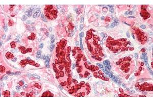 Detection of HBa1 in Human Erythrocytes of Placenta Tissue using Polyclonal Antibody to Hemoglobin Alpha 1 (HBa1) (HBA1 Antikörper  (AA 1-142))