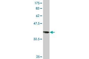 Western Blot detection against Immunogen (36. (RAD18 Antikörper  (AA 332-430))