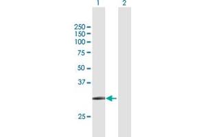 Western Blot analysis of SLC14A1 expression in transfected 293T cell line by SLC14A1 MaxPab polyclonal antibody. (SLC14A1 Antikörper  (AA 1-389))