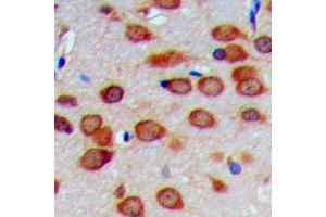 Immunohistochemical analysis of COX4-1 staining in human brain formalin fixed paraffin embedded tissue section. (COX IV Antikörper  (N-Term))