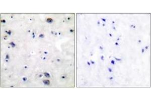 Immunohistochemistry analysis of paraffin-embedded human brain tissue, using Opioid Receptor (Ab-375) Antibody. (Opioid Receptor (AA 341-390) Antikörper)