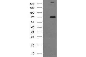 Image no. 4 for anti-Tumor Protein P73 (TP73) (AA 167-409) antibody (ABIN1491006) (Tumor Protein p73 Antikörper  (AA 167-409))