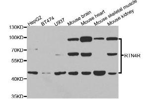 Western blot analysis of extracts of various cell lines, using RTN4R antibody. (RTN4R Antikörper)
