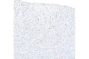 Immunohistochemistry (IHC) image for anti-Forkhead Box P3 (FOXP3) (AA 275-325) antibody (ABIN7795681)