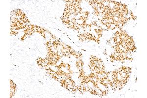 Immunohistochemistry (IHC) image for anti-Coactivator-Associated Arginine Methyltransferase 1 (CARM1) (C-Term) antibody (ABIN7454627)