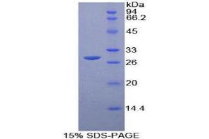 SDS-PAGE (SDS) image for Fc Receptor, IgG, High Affinity I (FCGR1) (AA 73-294) protein (His tag,T7 tag) (ABIN1879162)