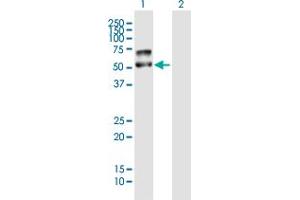 Western Blot analysis of PLD4 expression in transfected 293T cell line by PLD4 MaxPab polyclonal antibody. (Phospholipase D4 Antikörper  (AA 1-489))