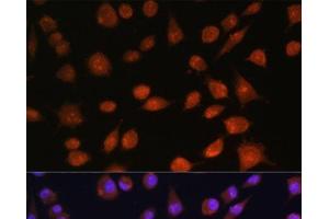 Immunofluorescence analysis of L929 cells using RPS19BP1 Polyclonal Antibody at dilution of 1:100. (RPS19BP1 Antikörper)
