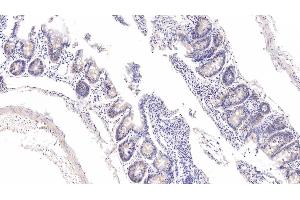 Detection of FXR in Rat Colon Tissue using Polyclonal Antibody to Farnesoid X Receptor (FXR) (NR1H4 Antikörper  (AA 375-568))
