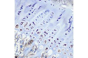 Immunohistochemistry of paraffin-embedded mouse bone marrow using Aggrecan Rabbit mAb (ABIN7265514) at dilution of 1:100 (40x lens). (Aggrecan Antikörper)