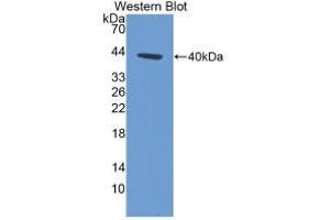 Western blot analysis of recombinant Human KRT14. (KRT14 Antikörper  (AA 111-418))