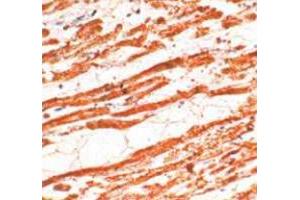 Immunohistochemical staining of human cardiac muscle stained with TNNT2 polyclonal antibody  at 1 : 50 for 10 min at RT. (Cardiac Troponin T2 Antikörper)