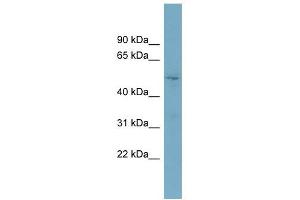 TOM1L2 antibody used at 1 ug/ml to detect target protein. (TOM1L2 Antikörper)
