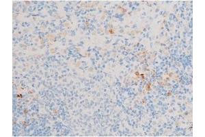 ABIN6256094 and ABIN6267526 at 1/200 staining Rat spleen tissue sections by IHC-P. (GATA4 Antikörper  (pSer105))