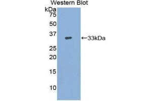 Western Blotting (WB) image for anti-Adenylate Cyclase 9 (ADCY9) (AA 1029-1282) antibody (ABIN1857914) (ADCY9 Antikörper  (AA 1029-1282))