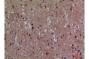 Immunohistochemical analysis of paraffin-embedded human brain, antibody was diluted at 1:100. (CDK4 Antikörper  (N-Term))