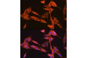 Immunofluorescence analysis of NIH-3T3 cells using PIK3C3/VPS34 Rabbit mAb (ABIN7269328) at dilution of 1:100 (40x lens). (PIK3C3 Antikörper)
